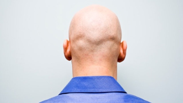 Bald-man-jpg